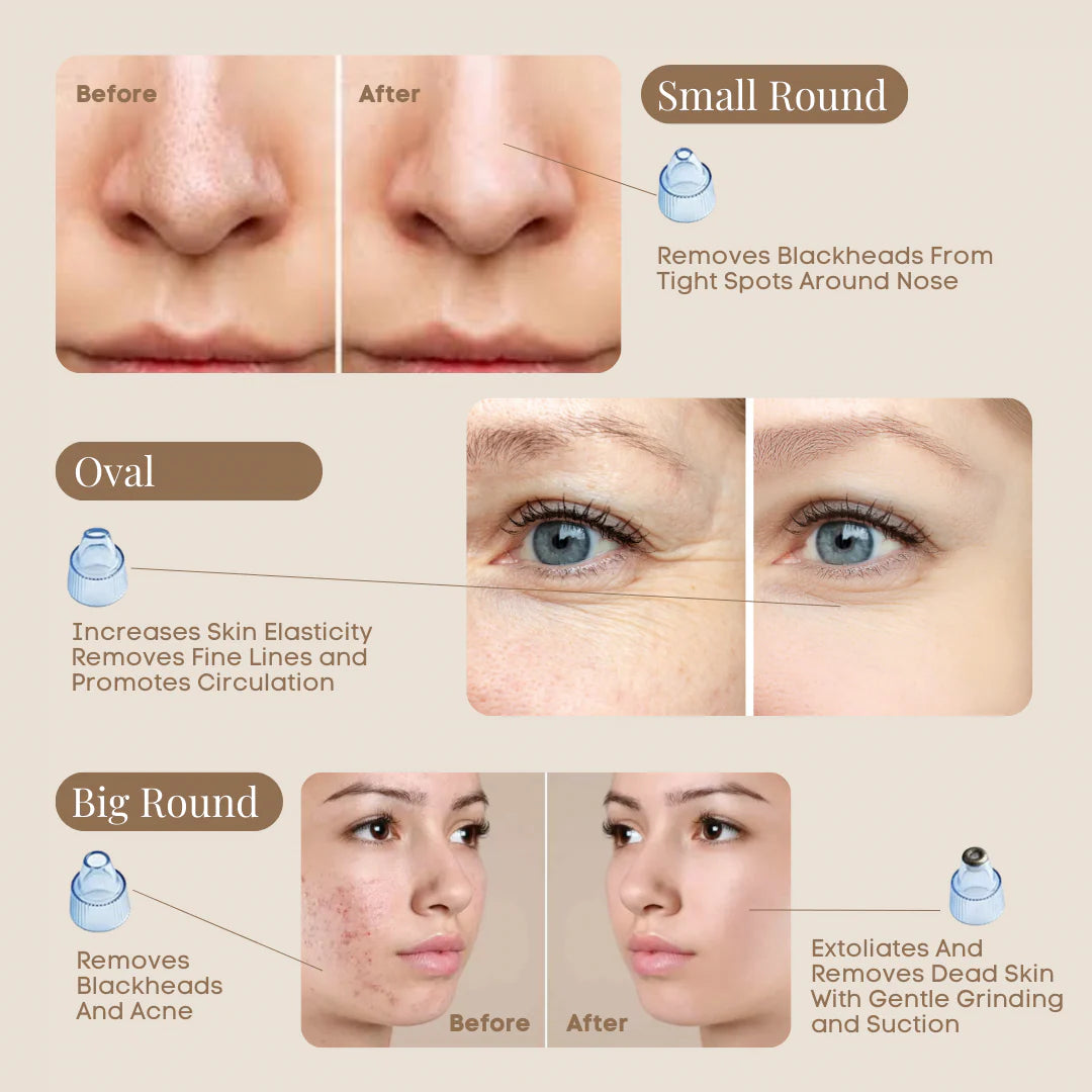 Chargeable Blackhead & Wrinkles removal tool