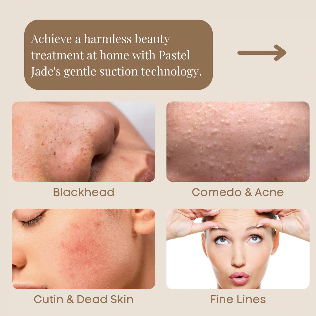 Chargeable Blackhead & Wrinkles removal tool